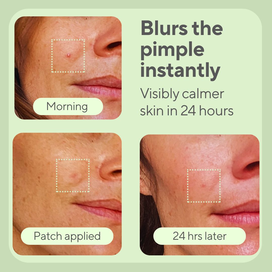 JustONEface Day & Night Patches