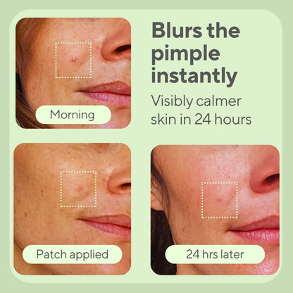 JustONEface Day & Night Patches