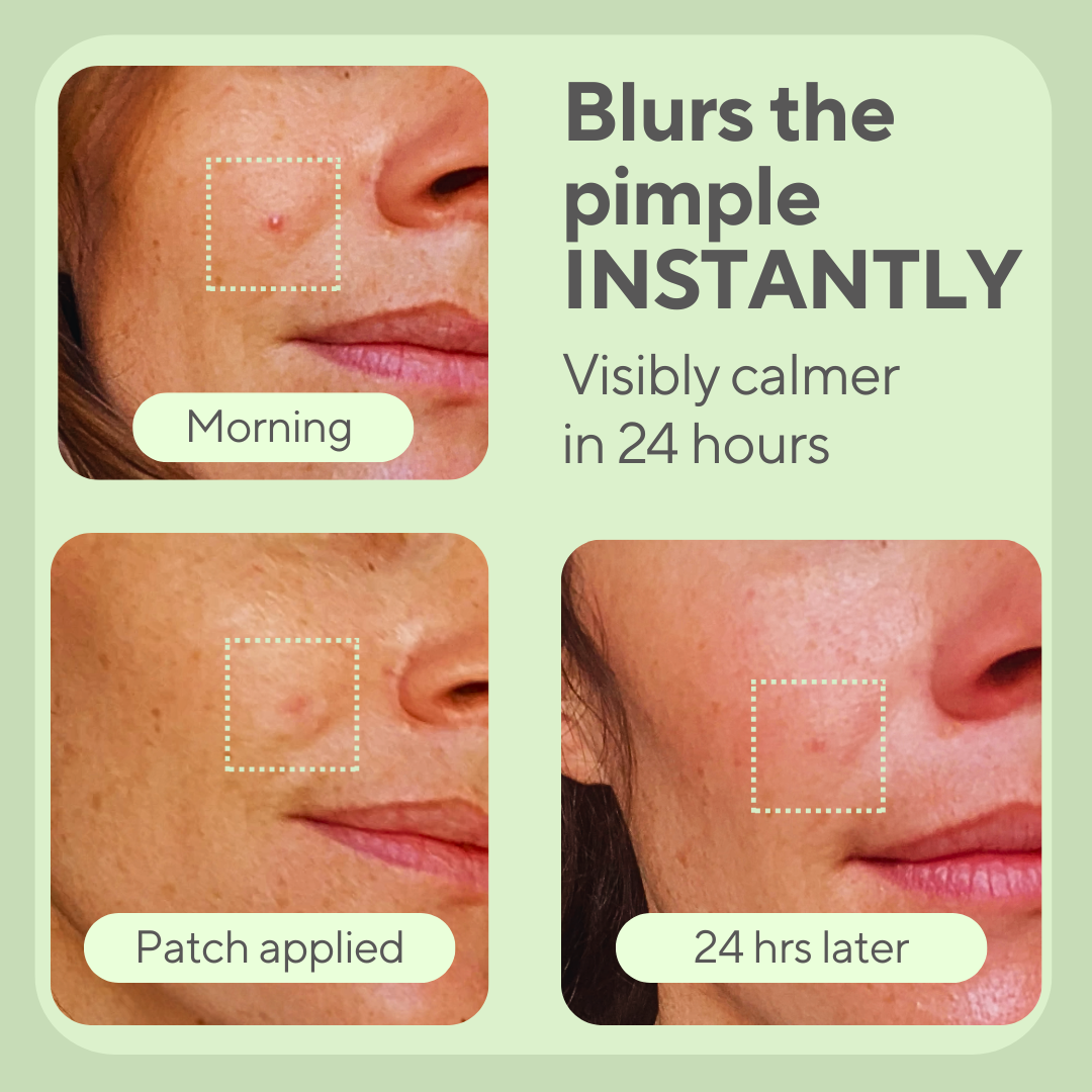 JustONEface Day & Night Patches