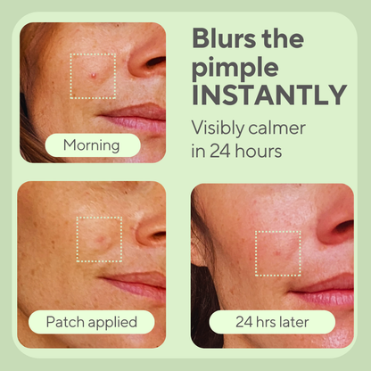 JustONEface Day & Night Patches
