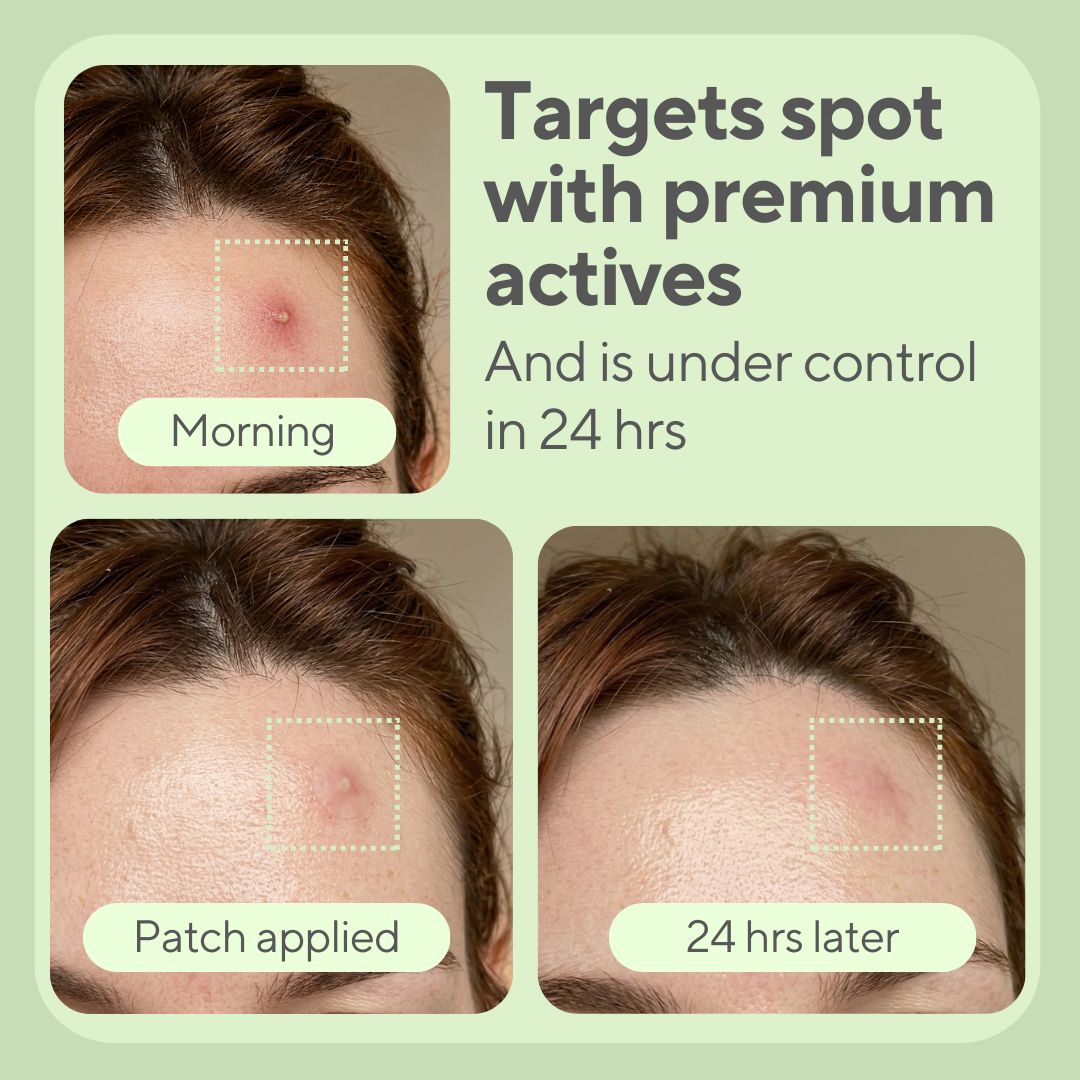 JustONEface Day & Night Patches