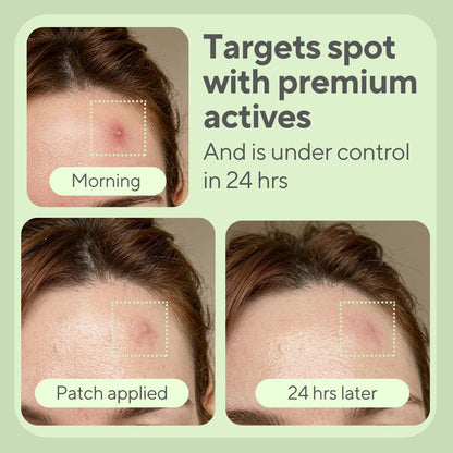 JustONEface Day & Night Patches