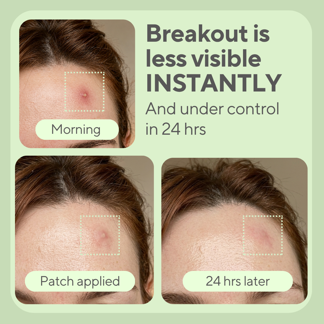 JustONEface Day & Night Patches