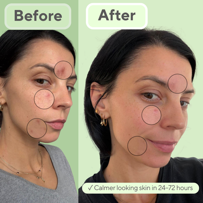 JustONEface Day & Night Patches